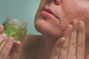  Как да се отървете от белези след акне