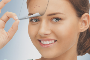  Как да се отървете от акне