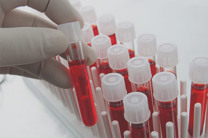  Как да намалите нивото на адреналина