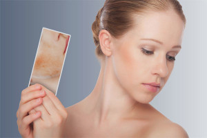  Как да се отървете от съдови звезди на лицето