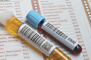  Как да намалите пикочната киселина в кръвта