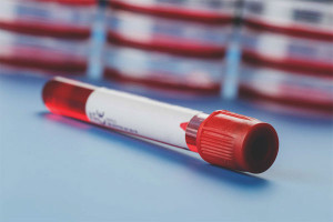  Как да увеличите хемоглобина по време на бременност