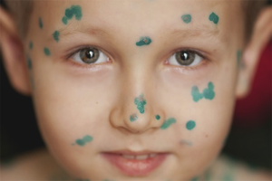  Как да се измие брилянтно зелено