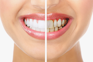  Как да премахнете плаката