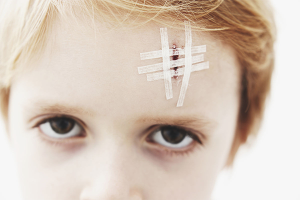  Как да се отървете от драскотини по лицето