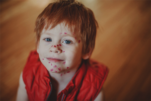  Как да измиете Fukortsin с кожата