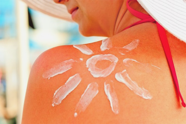 Bronzlaşma sonrası kızarıklık nasıl kaldırılır