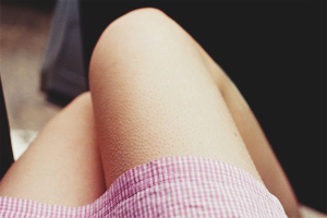  Как да се отървем от гъши дробове на краката