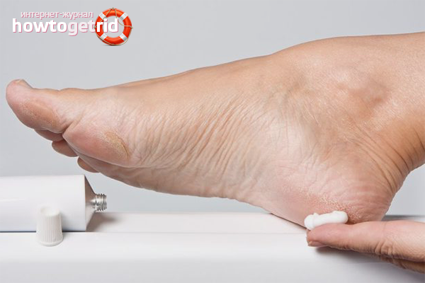 Topuk dikeni için ilaç preparatları