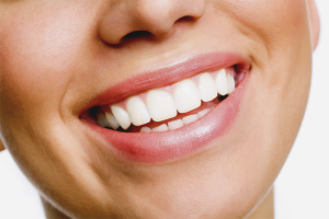  Как да избелите зъбите си
