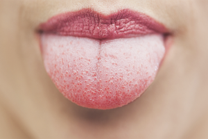  Върхът на езика боли