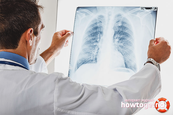 Форма и диагностика на туберкулозата