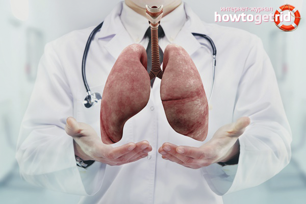 Предотвратяване на туберкулозата