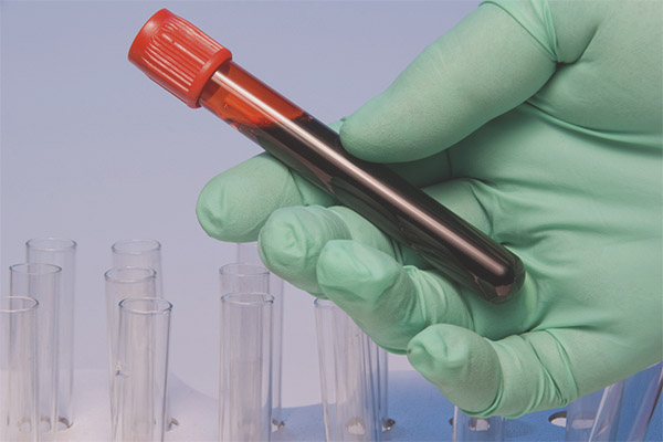 Дебела кръв по време на бременност