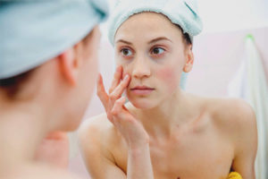  Чували под очите