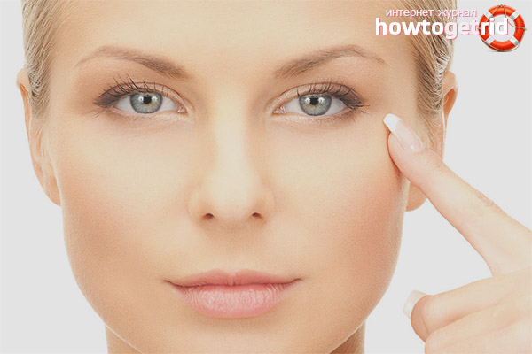 Причини за оток на клепачите