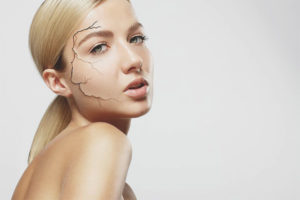  Суха кожа на лицето