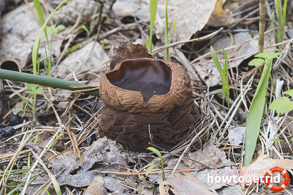 Места на глобуларния саркозом